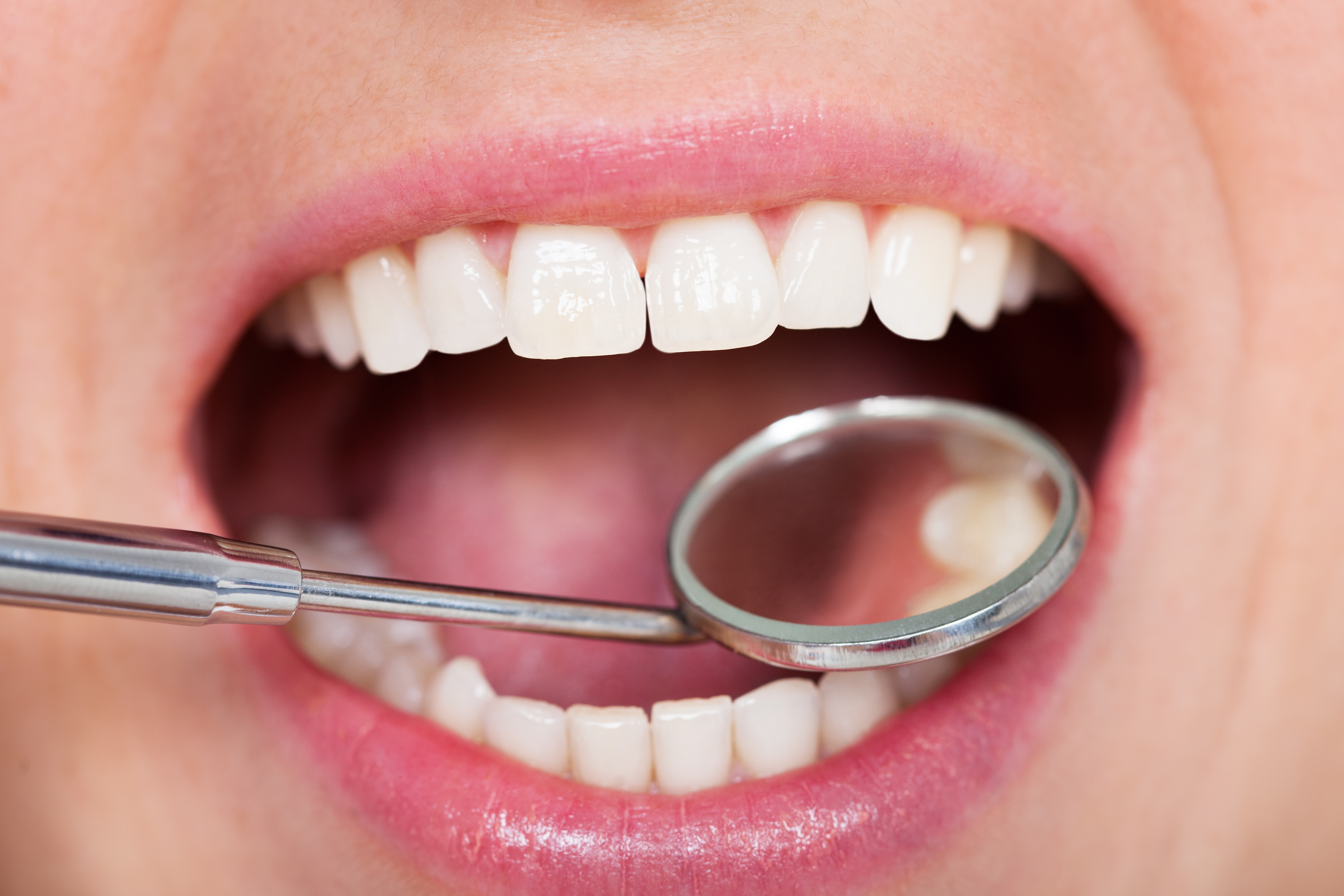 londonderry fillings