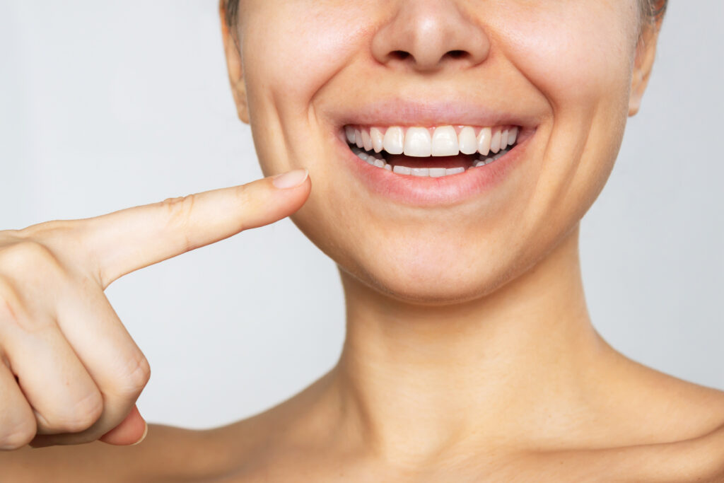 londonderry teeth whitening