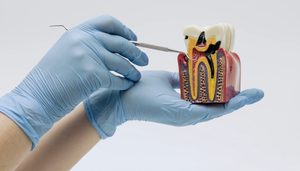 londonderry root canal